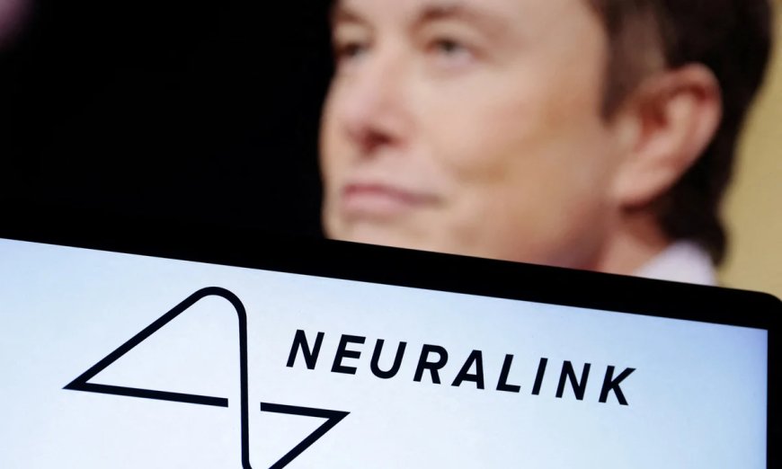 Implan Neuralink memperluas kemampuan bagi pengguna